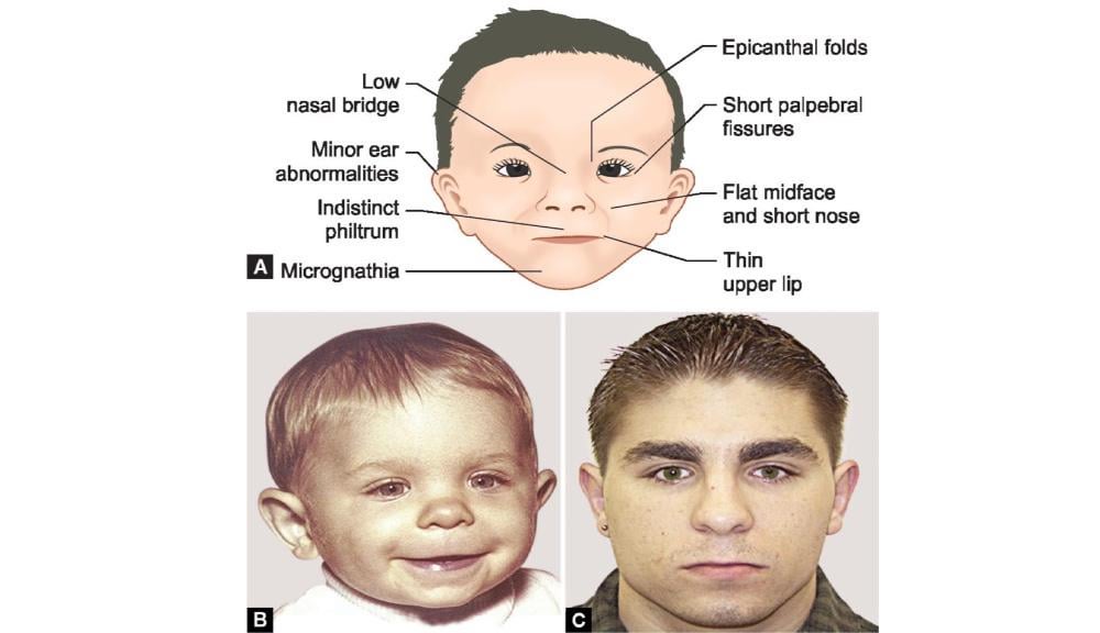 Is it just me that reminds me of one of our TV presenters?