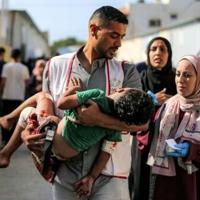 ‘American Doctor’ tells of brutality in Israel-Hamas war | News 'American Doctor' tells of brutality in Israel-Hamas war | News