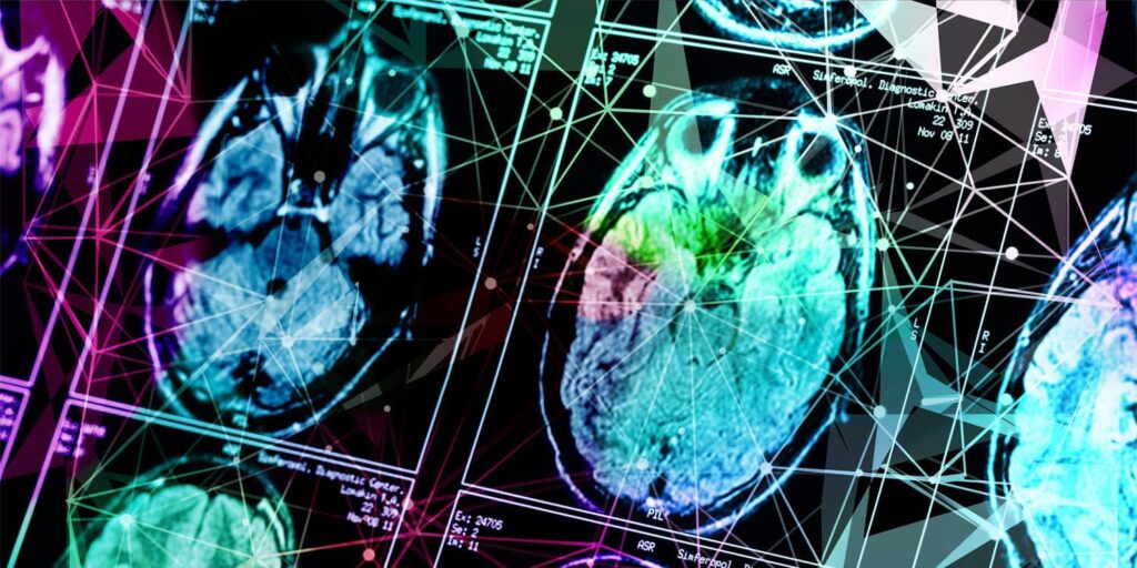 Common air pollutants associated with structural changes in the teenage brain