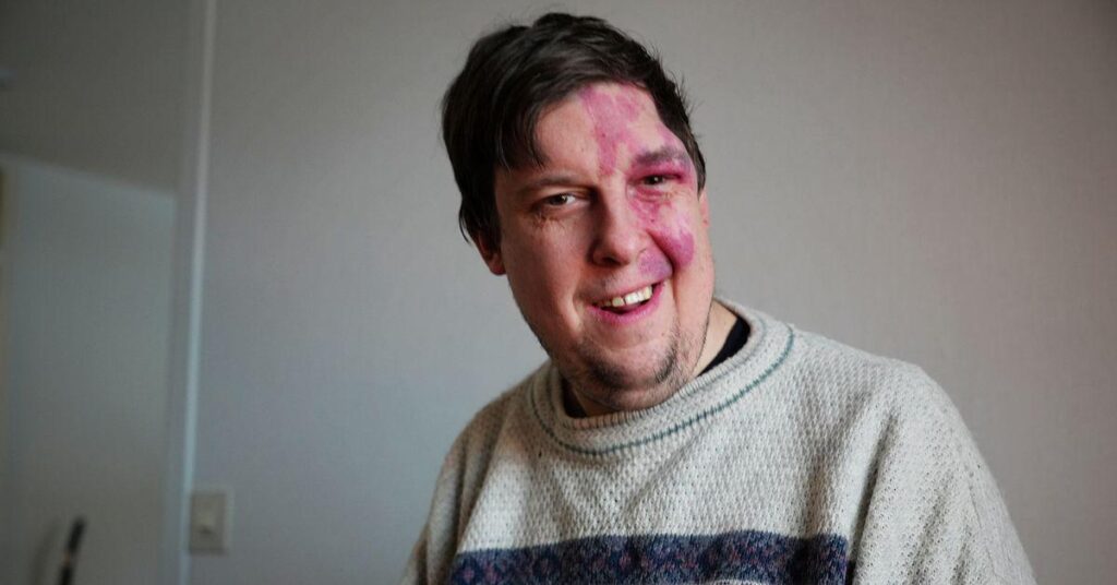 Jakob, 38, struggled with loneliness: “An appearance-fixated world” Jakob, 38, struggled with loneliness: "An appearance-fixated world"