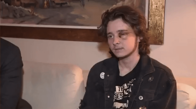 21 year old activist injured by ICE: I will be blind for life. I have fractures in my skull that they can't fix. I can't sneeze or cough because it's dangerous to. I had shards of metal, glass, and plastic behind my eye and in my skull.