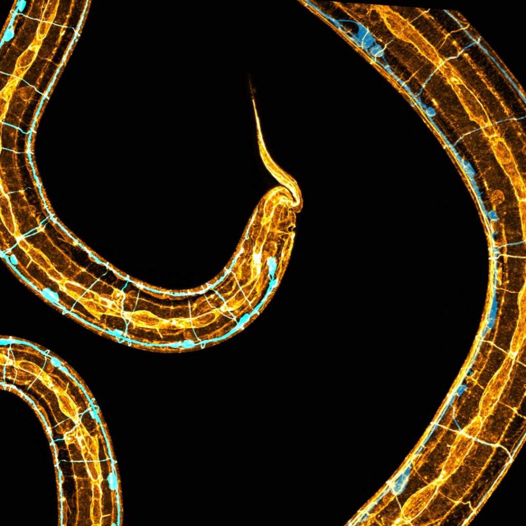 Researchers at UQ’s Queensland Brain Institute (QBI) and the School of Biomedical Sciences have discovered a nanoscale molecular scaffold that exists in the tissue that surrounds the axon that protects sensory axons from degenerating.