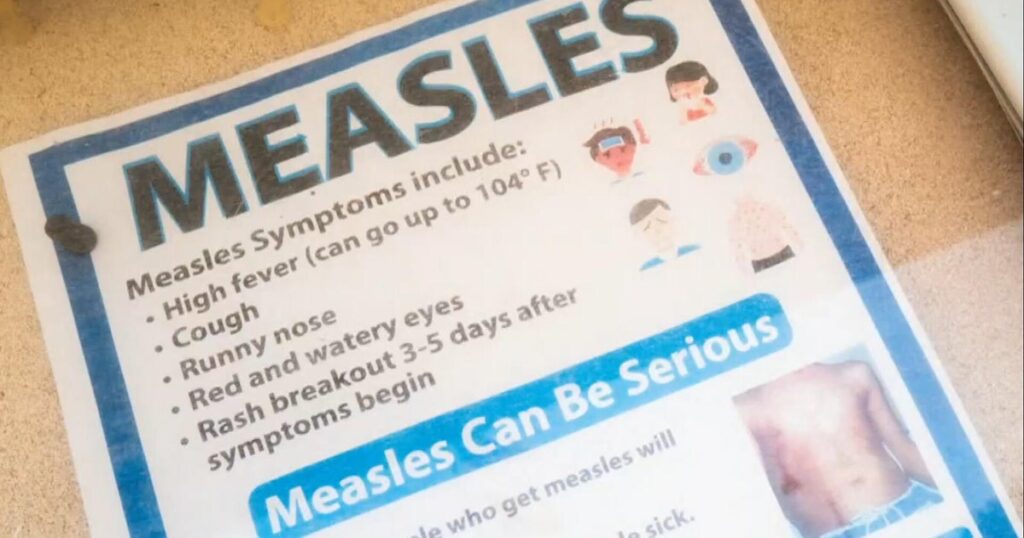 LA County public health confirms first measles case in 2026