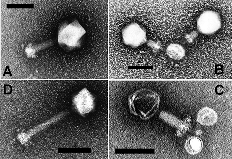 Four highly magnified images show a tiny round object, the virus. In two of the images, the tail is visible.