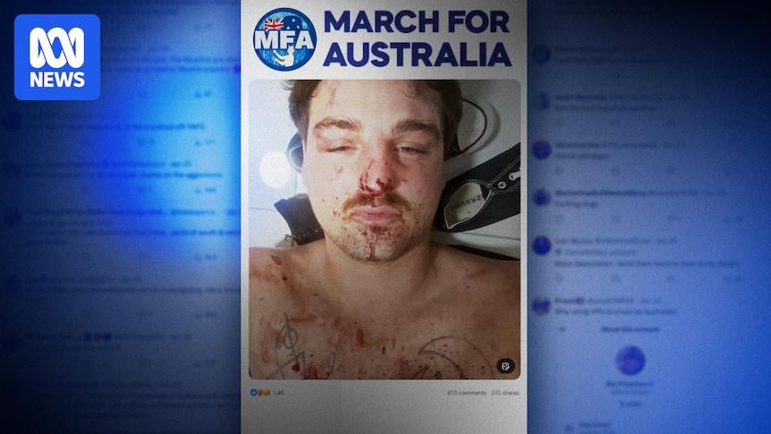 Police reject claim March for Australia organiser was bashed by Middle Eastern men