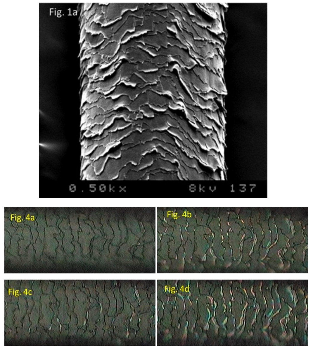 hair cuticle scales buckle