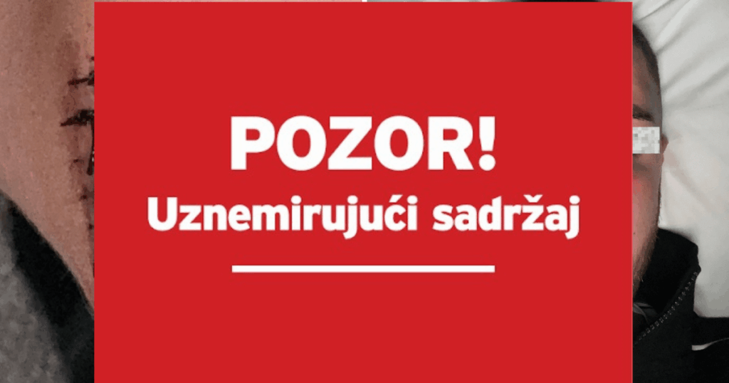 HORROR IN BELGRADE Croats were beaten on New Year's Eve: 'In Zemun they sewed up my tongue wrongly'