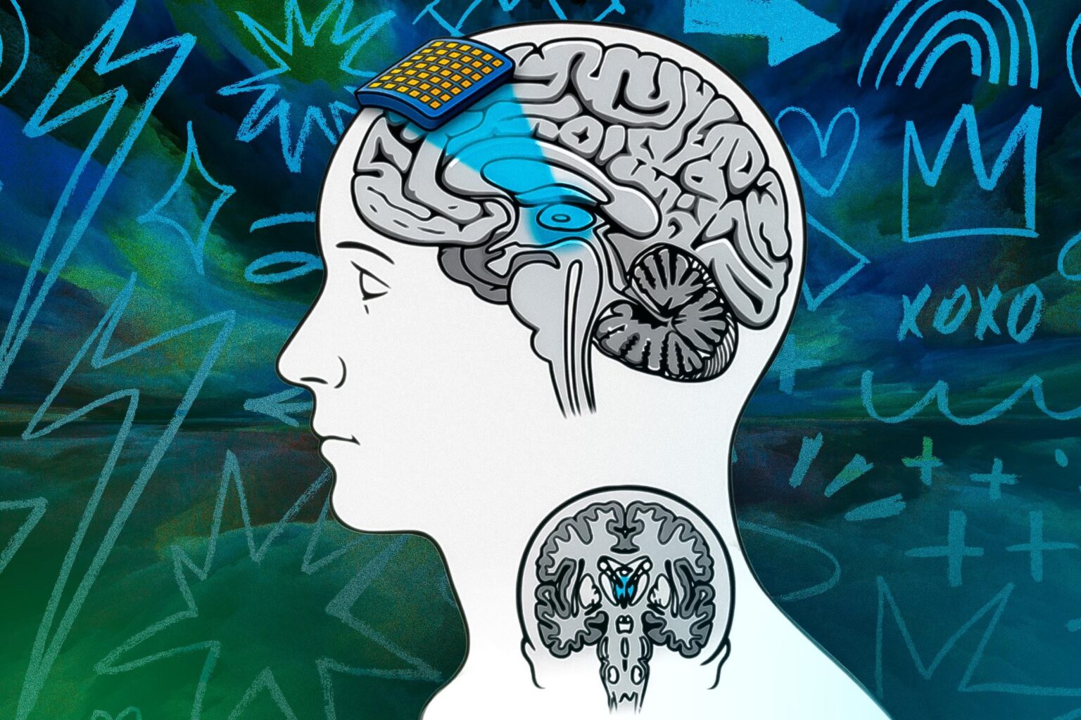 A new brain manipulation tool could help us understand consciousness better