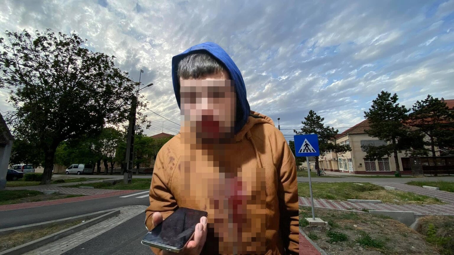 Young man disfigured by the teenagers arrested for the murder of Mario Berinde. The victim withdrew his complaint five days before the aggressors committed the crime in Cenei: "One of the parents of the criminals called him to the station"