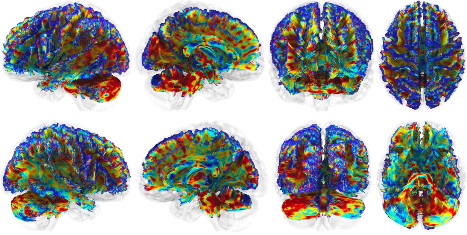 Medical-Grade Near-Infrared Light Therapy at Specific Frequencies Shows Promise for Protecting Football Players’ Brains