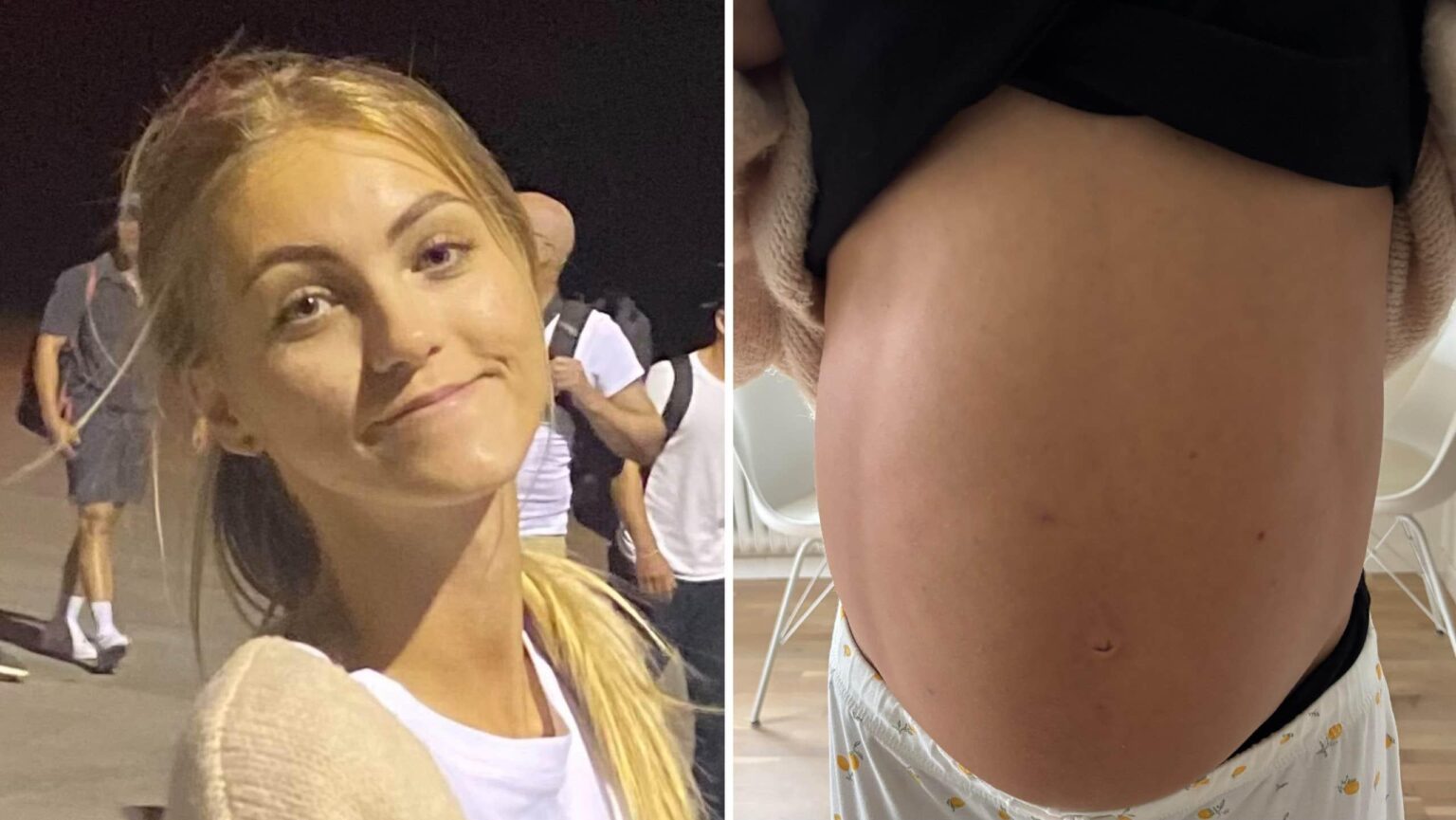 Nora, 22, was dismissed by healthcare - had a 10 kilo cyst