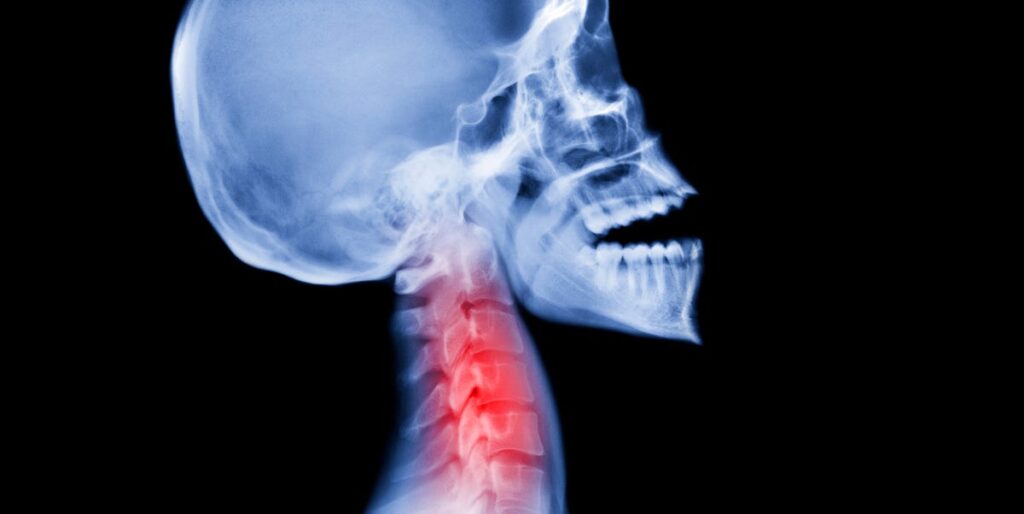 How Neanderthal Genes Influence Today’s Sensitivity How Neanderthal Genes Influence Today's Sensitivity