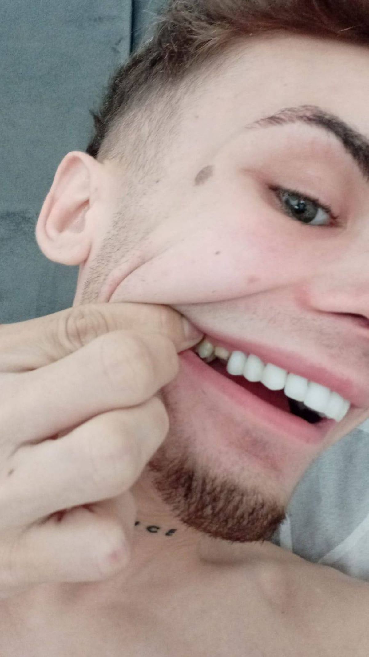 A close-up image depicts a person's face, with one hand gently tugging at the corner of their mouth, revealing a glimpse of their teeth. The facial expression is one of slight discomfort or amusement.