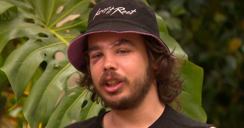 Melbourne tradie left with serious injuries after road rage attack by e-scooter rider