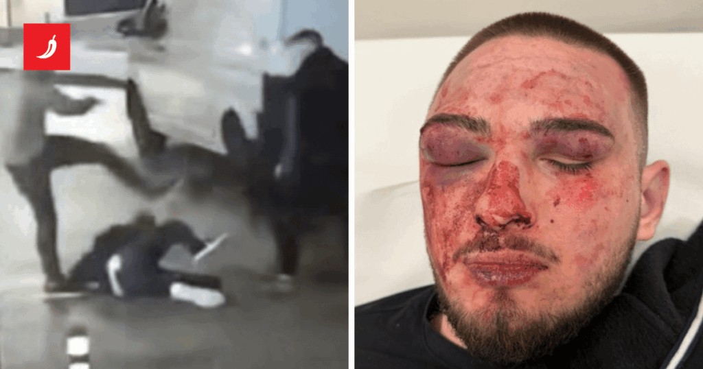 A 16-year-old boy was beaten in Rijeka, they kicked him, dragged him... Father: They beat him for no reason