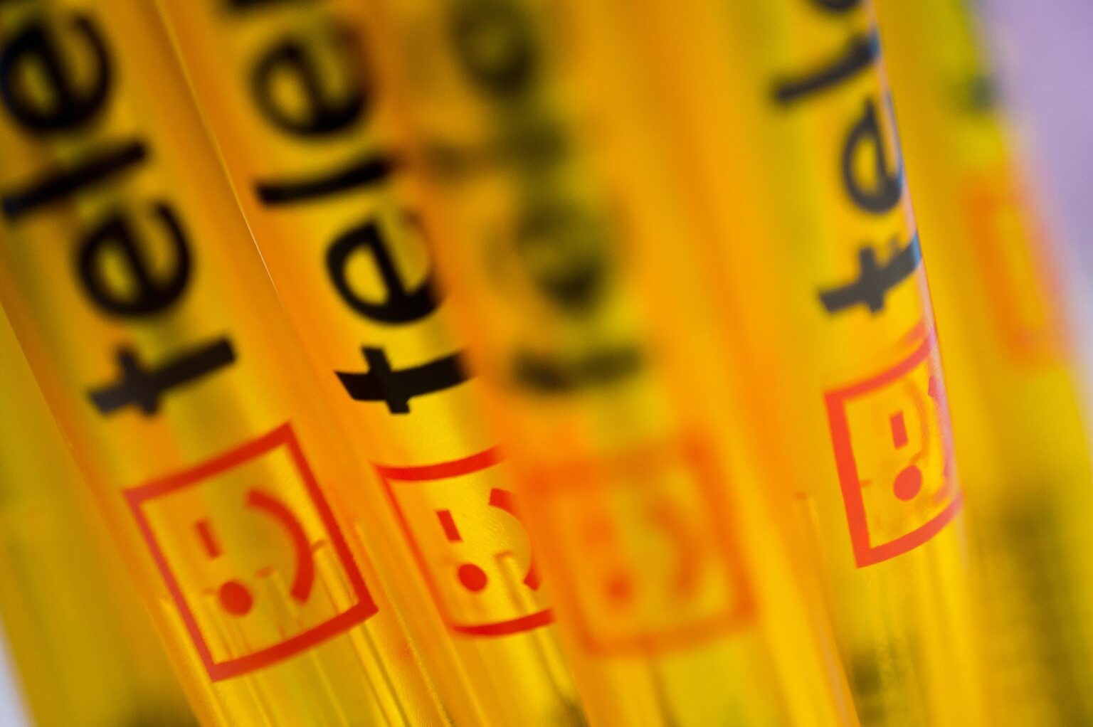 Telenet to cut jobs and close several stores