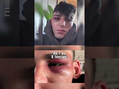 Homophobia: a referee attacked at home after a marriage proposal