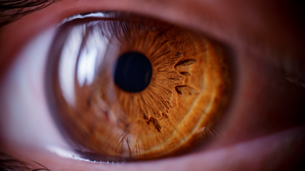 Purpureocillium lilacinum Keratitis Outbreak Associated with an Ophthalmology Clinic — New York City, 2024