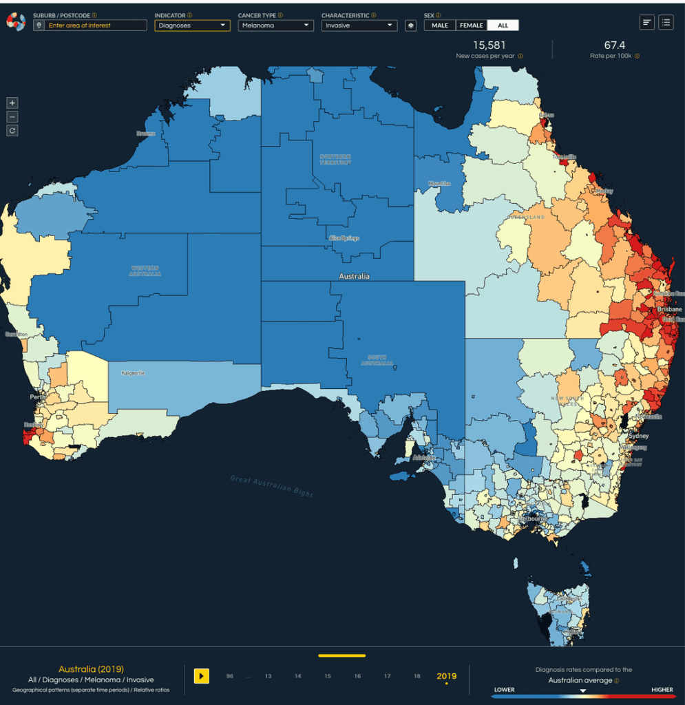 Melanoma diagnosis and survival rates