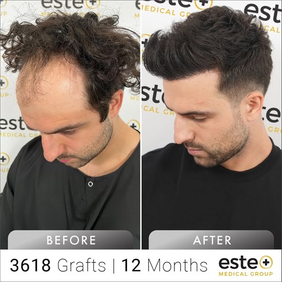 Cannot view this image? Visit: https://www.byteseu.com/wp-content/uploads/2026/03/288595_75be4aae74b939ee_002.jpg