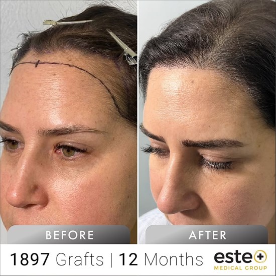 Cannot view this image? Visit: https://www.byteseu.com/wp-content/uploads/2026/03/288595_75be4aae74b939ee_003.jpg