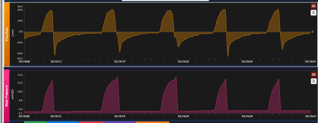 [OC]I built a system that visualizes CPAP sleep therapy data in advanced interactive charts