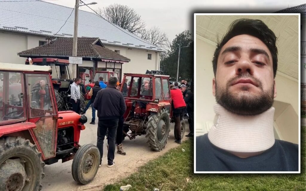 “HE SHOUTED THAT WE SHOULD ALL BE KILLED”: SNS supporter brutally beat the organizer of farmer blockades!