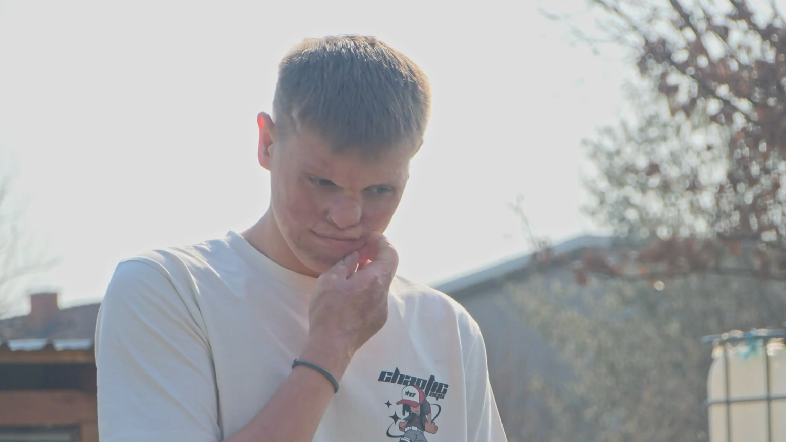 [Apel za pomoć] Let's help Christian get a chance for a new start and a face without scars