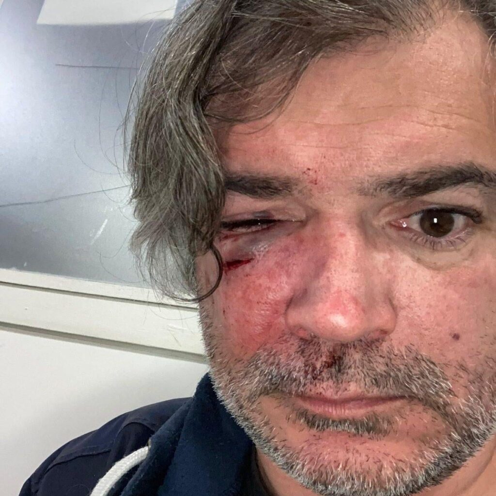 Nîmes: what we know about the attack on communist activists by supporters of right-wing candidate Franck Proust