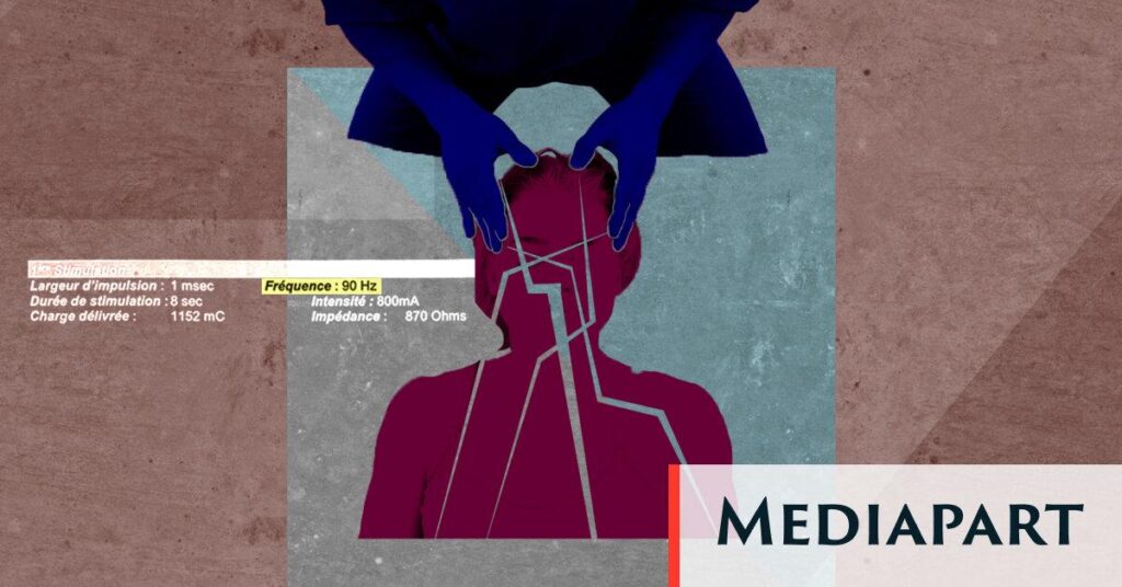 Psychiatry: a young woman undergoes 85 electroshock sessions and loses her memory