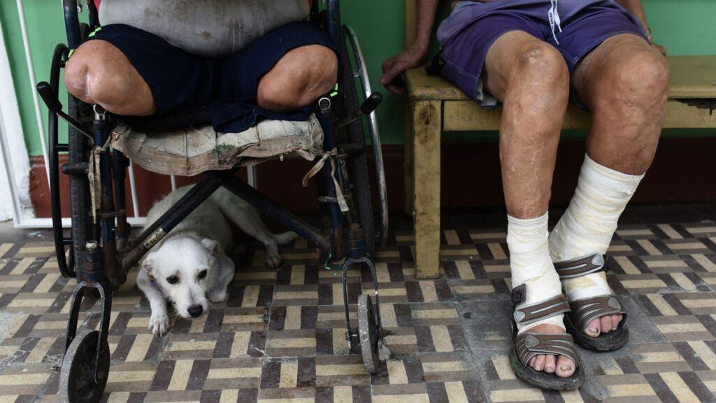 Chile is only the second country in the world to defeat leprosy