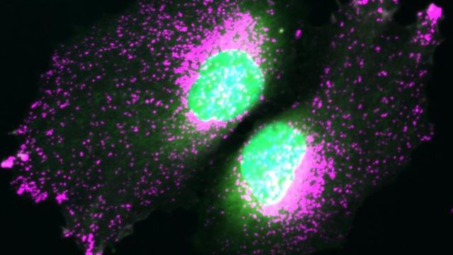 Molecular Switch Controls Lysosome Function Molecular Switch Controls Lysosome Function