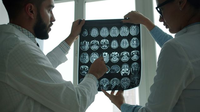 Alzheimer’s Brain Lesions May Shrink Over Time Alzheimer’s Brain Lesions May Shrink Over Time
