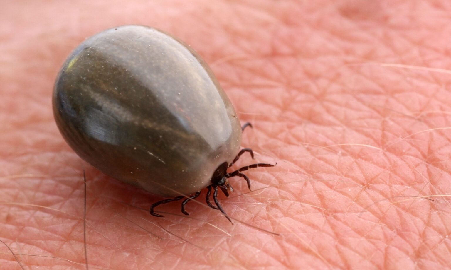 Researchers question link between tick bites and chronic illness