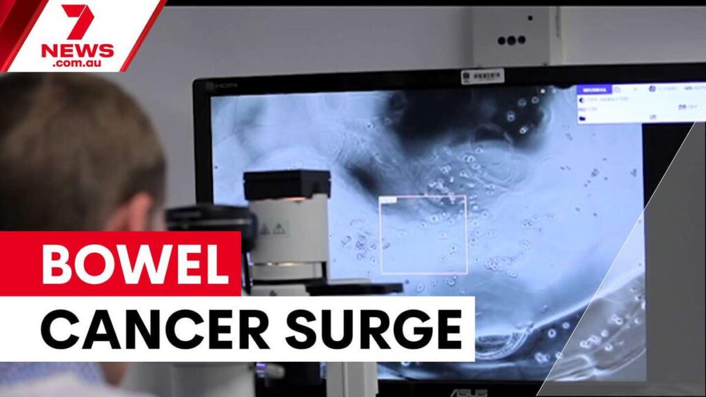 Young Australians face rising bowel cancer rates