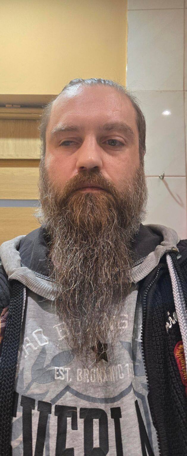 hello I’ve been growing a beard for a while now, tomorrow I’m starting an experiment with dermroller and minoxidil (I’ll try to save baldness too). I noticed that there is zero Lithuanian content on this topic. Would anyone be interested in seeing the progress/reviews, or is it the same for everyone? hello I've been growing a beard for a while now, tomorrow I'm starting an experiment with dermroller and minoxidil (I'll try to save baldness too). I noticed that there is zero Lithuanian content on this topic. Would anyone be interested in seeing the progress/reviews, or is it the same for everyone?
