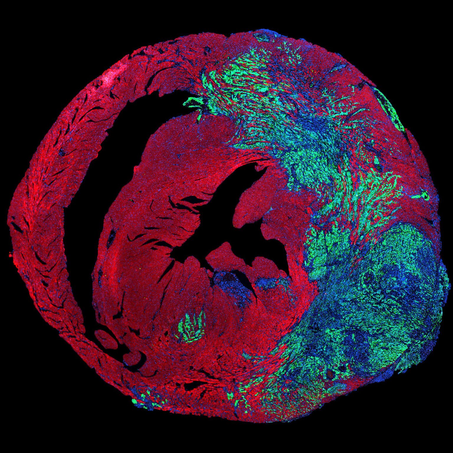 Heartbeat’s mechanical force found to suppress tumour growth: « An international study reveals how mechanical forces in cardiac tissue inhibit cancer cell proliferation. »