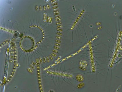 Phytoplankton under magnification
