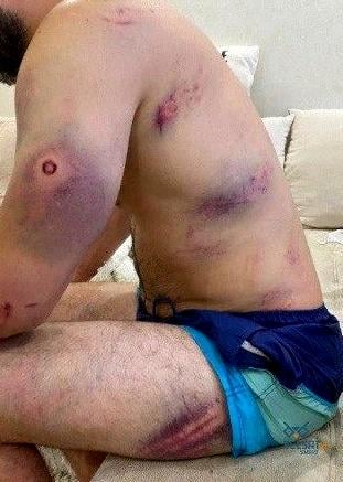How yesterday's special treatment by riot police in Minsk looks like