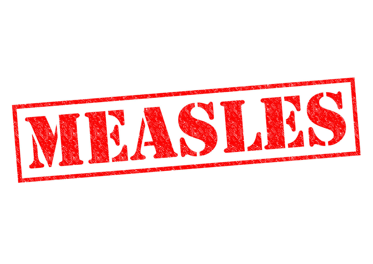 Following new measles exposures, Placer health officials encourage proactive steps for unvaccinated individuals