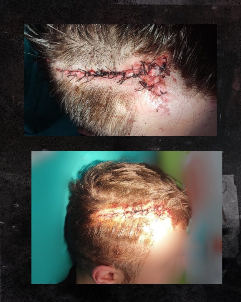 Announcement on the occasion of the election night on March 29 in Arandjelovac