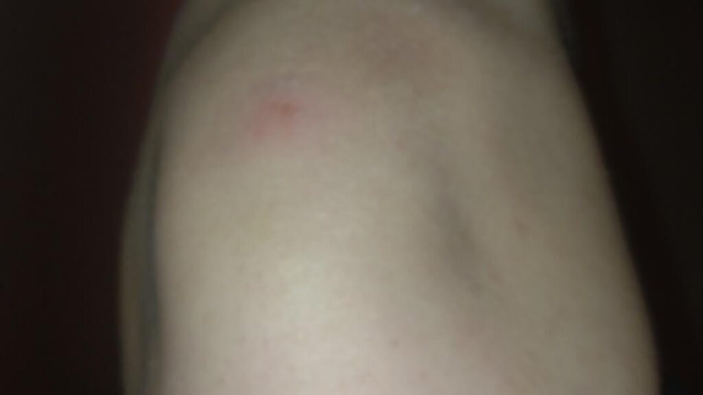 Roommate aggressive against me, will the police help? Roommate aggressive against me, will the police help?