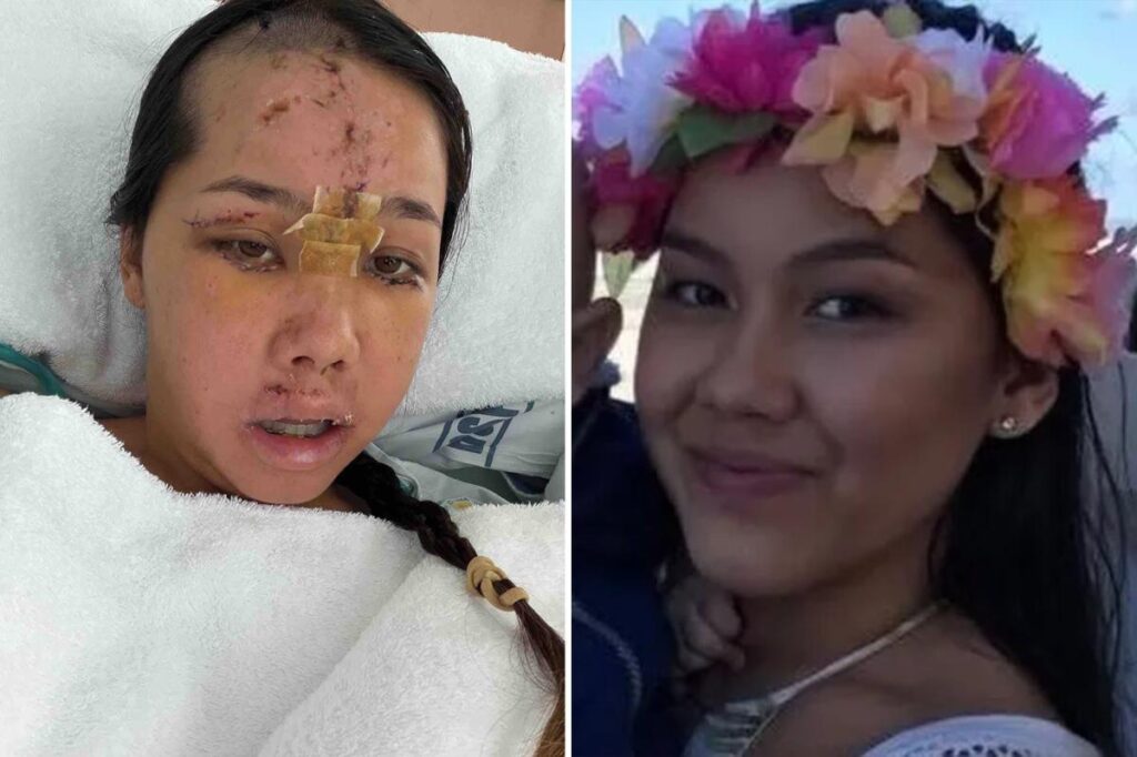 Tourist left fighting for life in ICU in New Zealand during vacation trip Tourist left fighting for life in ICU in New Zealand during vacation trip