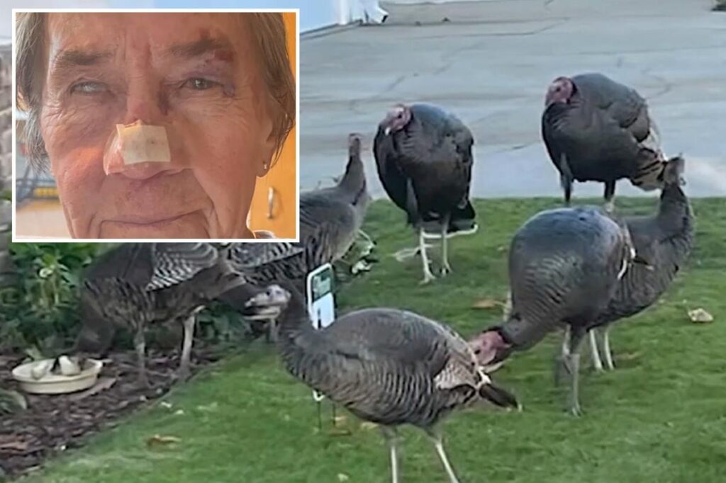 Wild turkey attack leaves Alameda woman, 83, bloodied and needing six stitches Wild turkey attack leaves Alameda woman, 83, bloodied and needing six stitches
