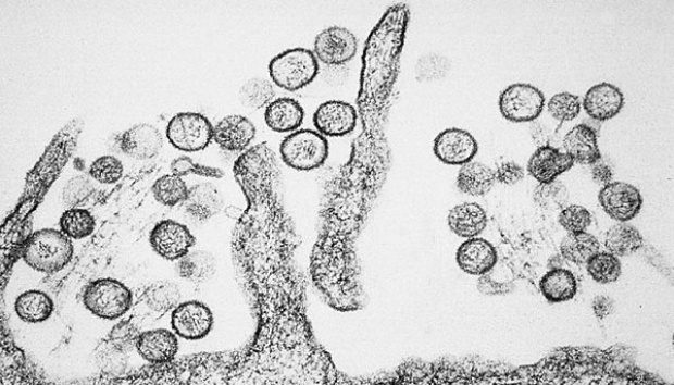 Belarus Reports About 50 Hantavirus Cases Annually