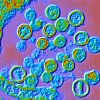 This color-enhanced micrograph image shows hantavirus particles as blue and green circles, sometimes with a reddish border.