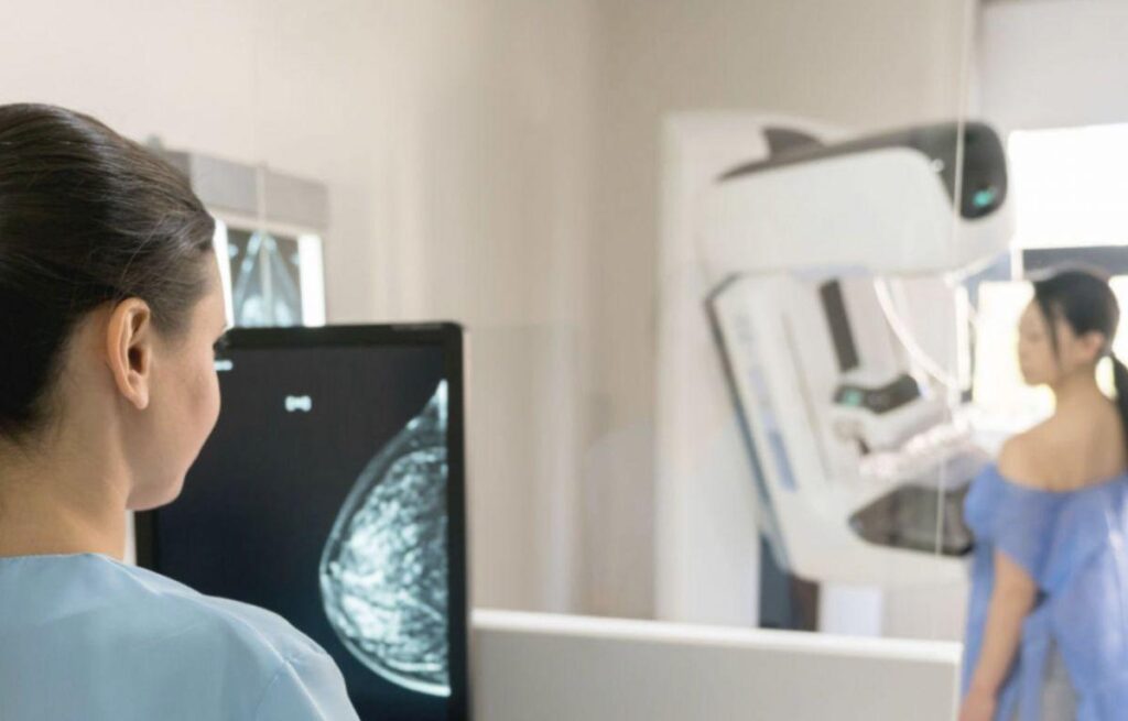 Health is already working on bringing up screening for breast cancer to age 45