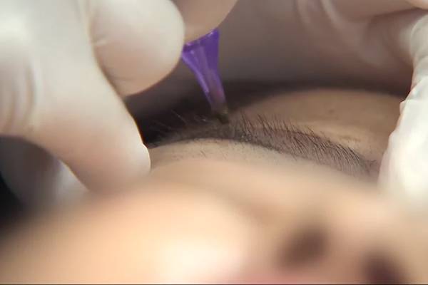 Supreme Court Changes Stance on Tattooing after 34 Years