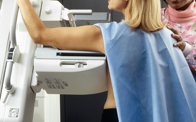 Nearly half of Estonia's new breast cancer cases caught by screening | News