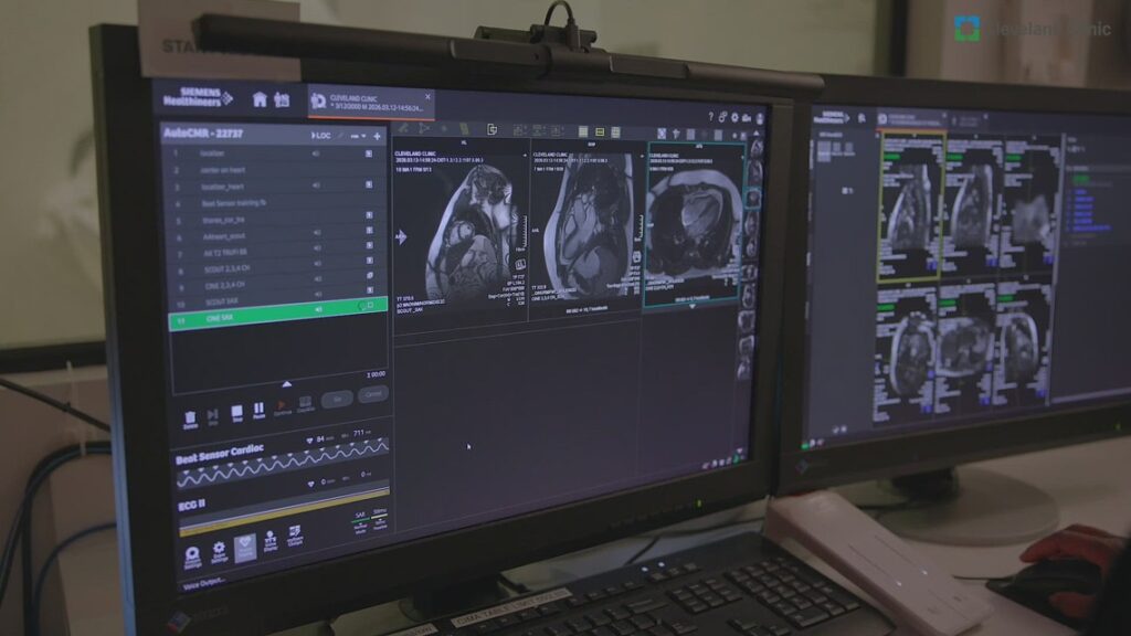 AI technology revolutionizes heart scan interpretation with 99% accuracy AI technology revolutionizes heart scan interpretation with 99% accuracy